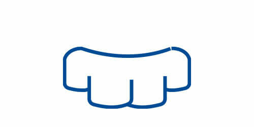 Invisalign